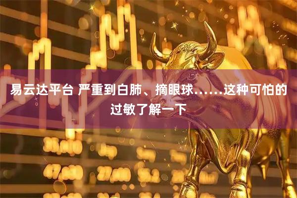 易云达平台 严重到白肺、摘眼球……这种可怕的过敏了解一下